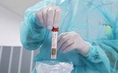 ΕΟΔΥ: Ημερήσια έκθεση επιδημιολογικής επιτήρησης λοίμωξης από το νέο κορωνοϊό. 1 κρούσμα στην Ημαθία