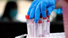 Ημερήσια έκθεση επιδημιολογικής επιτήρησης λοίμωξης από το νέο κορωνοϊό (2/8)
