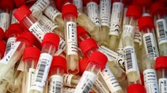 ΜΠΛΑΚ ΑΟΥΤ» ΜΕ ΤΑ ΤΕΣΤ ΚΟΡΟΝΟΪΟΥ!