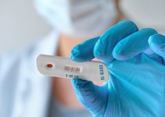 Δωρεάν rapid tests στη Νάουσα και την Επισκοπή