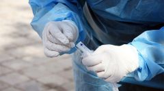 Ημερήσια έκθεση επιδημιολογικής επιτήρησης λοίμωξης από το νέο κορωνοϊό 7/2