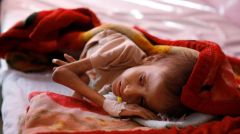 ΕΚΘΕΣΗ ΤΟΥ ΟΗΕ: Εκτινάχθηκε το 2021 ο αριθμός των ανθρώπων που βρίσκονται στο φάσμα της πείνας