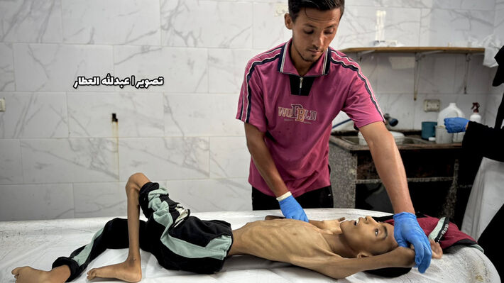 Ξεχειλίζει η υποκρισία και ο κυνισμός των ιμπεριαλιστών ενώ στη Γάζα 93 παιδιά έχουν πεθάνει από την πείνα