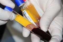 ΤΙ ΕΙΝΑΙ ΦΑΣΙΣΜΟΣ;