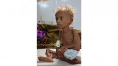 ΥΕΜΕΝΗ: Πάνω από 11 εκατομμύρια παιδιά έχουν απελπιστική ανάγκη ανθρωπιστικής βοήθειας