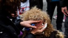 ΕΛΜΕ Ημαθίας:Για το άγριο χτύπημα της κυβέρνησης στους διαδηλωτές εκπαιδευτικούς!
